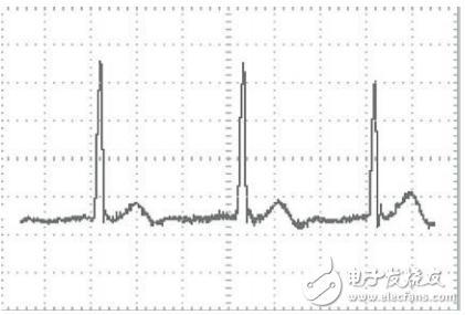 基于STM32芯片和TFT-LCD的便攜式心電圖儀設(shè)計